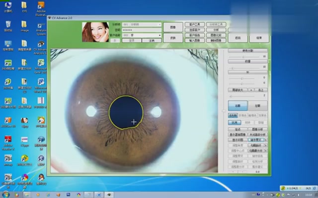 虹膜检测热门